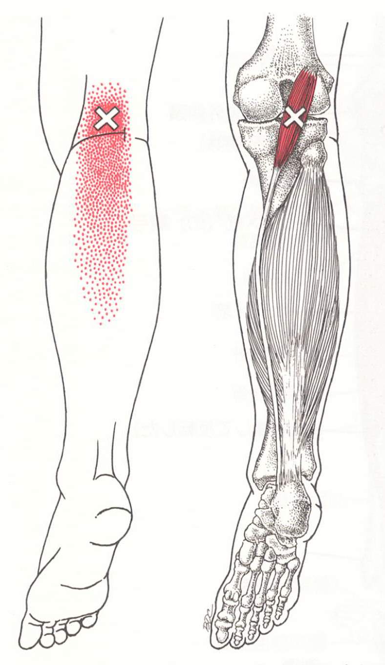 正座をしようとすると膝が痛む | 筋筋膜性疼痛症候群・トリガーポイント施術 ラムサグループ